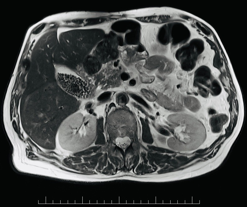 Pelvic MRI example