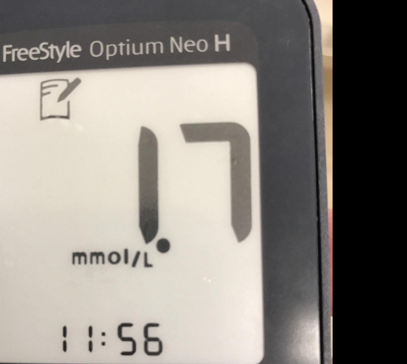 Continuous glucose monitor showing low glucose in insulinoma