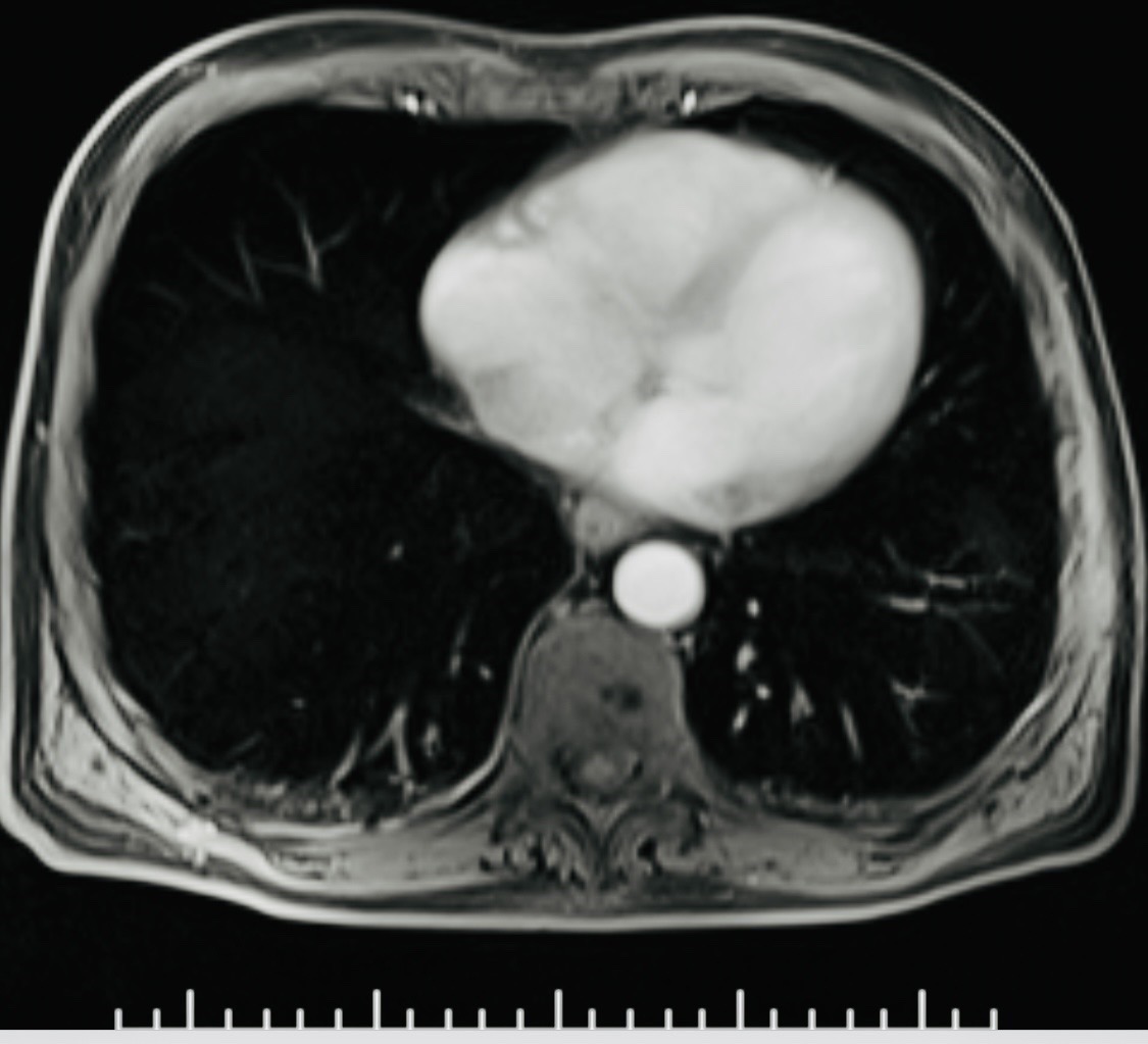 Cross-sectional imaging example